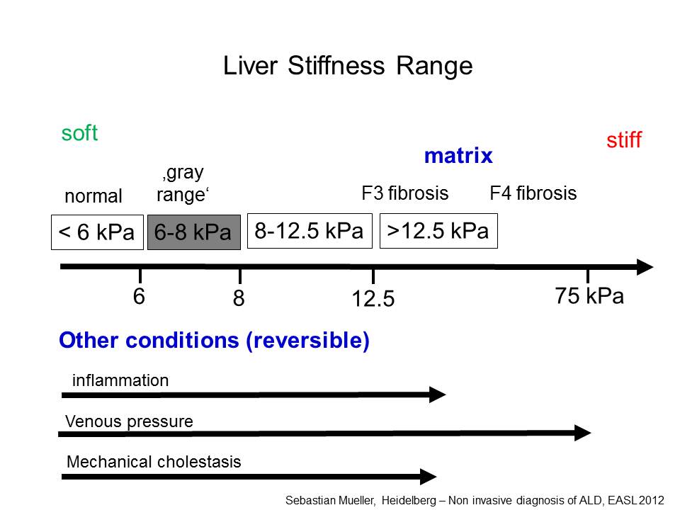 Liver stiffness